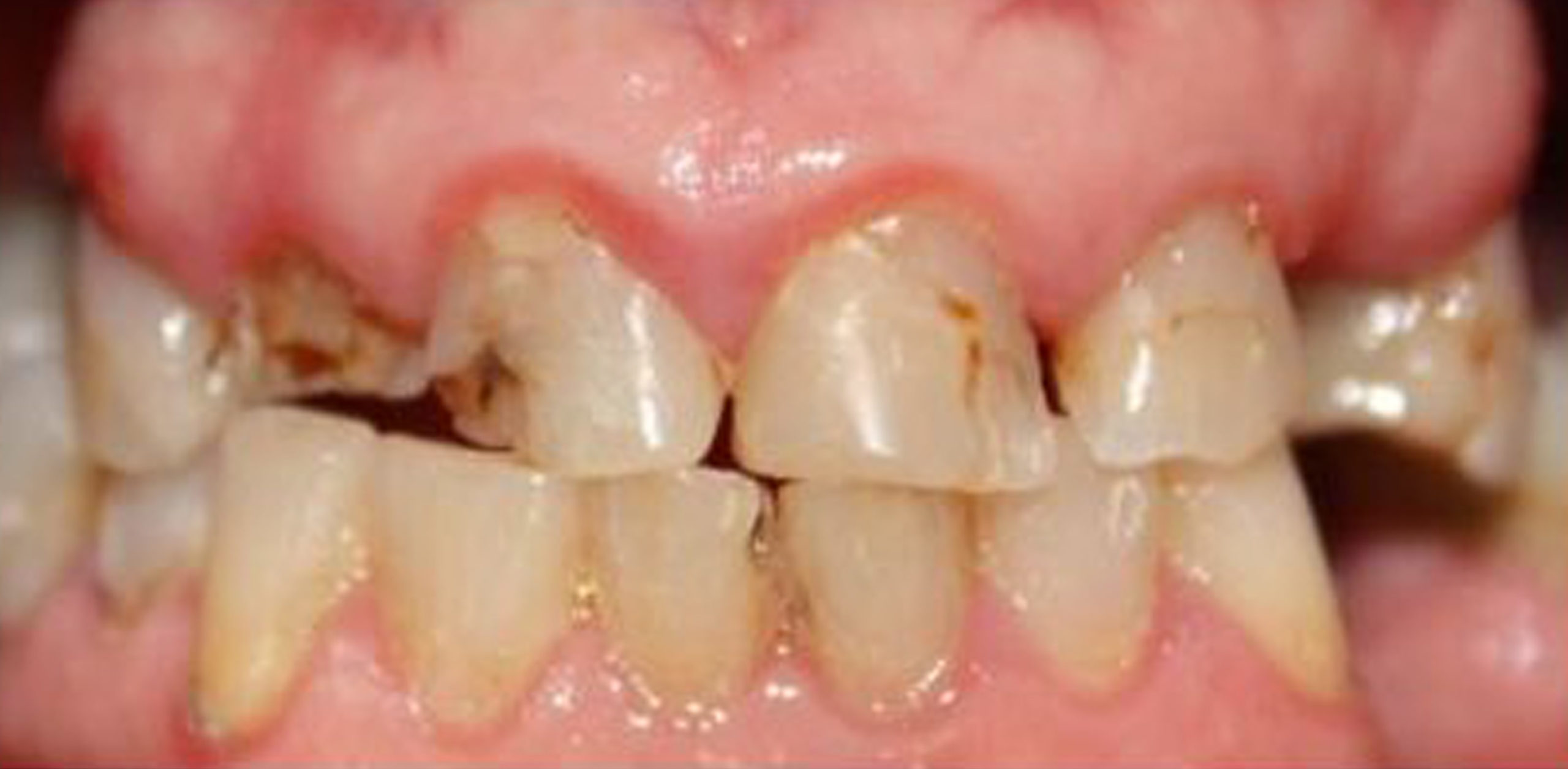 Before & After Results West Bowmanville Family Dental