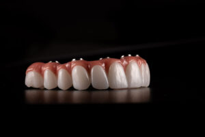 Full arch fixed dental prostheses on dental implant with black background. Zircon bridge on 4 dental implants