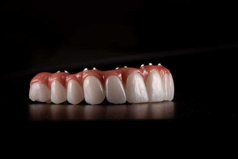 Full arch fixed dental prostheses on dental implant with black background. Zircon bridge on 4 dental implants
