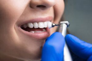 close up of person having a dental cleaning