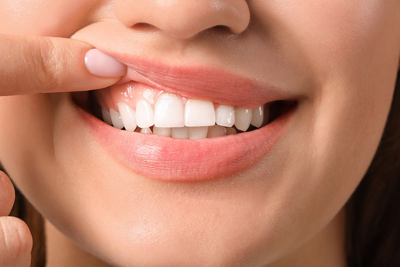 woman showing off her teeth
